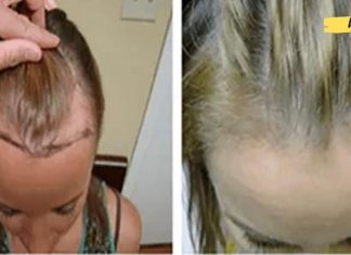 ალბათ ეს მცენარე თქვენს ბაღში იზრდება, მაგრამ თქვენ არ იცოდით, რომ მას შეუძლია სიმელოტისა და რევმატიზმის განკურნება!