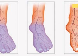 20 წუთზე ნაკლებ დროში მოაწესრიგეთ ცუდი სისხლის მიმოქცევა!