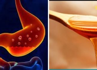 უმკურნალეთ გასტრიტს სახლის პირობებში. ეს აქამდე უნდა გამეკეთებინა