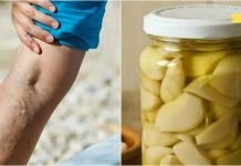 ნიორი ხელს უშლის ვარიკოზული ვენების წარმოქმნას. რეცეპტი იხილეთ სტატიაში!