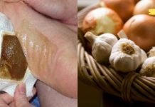 მოიშორეთ საშიში ტოქსინები მხოლოდ 1 ღამეში!