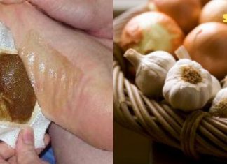 მოიშორეთ საშიში ტოქსინები მხოლოდ 1 ღამეში!