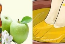 აი რა მოხდება როდესაც ფეხებს ვაშლის ძმარში ჩააწყობთ! ეს წარმოუდგენელია!