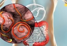 თუ ორგანიზმში არსებულმა პარაზიტებმა შემოგიტიათ, მაშინ ეს უნდა გააკეთოთ!