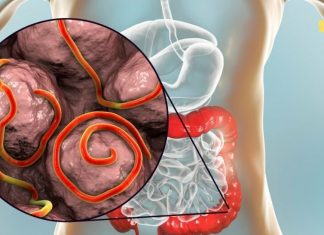 თუ ორგანიზმში არსებულმა პარაზიტებმა შემოგიტიათ, მაშინ ეს უნდა გააკეთოთ!