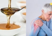 უმკურნალეთ მხრის სახსრის ართროზს თაფლის საშუალებით