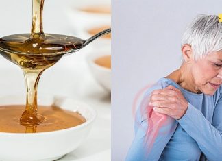 უმკურნალეთ მხრის სახსრის ართროზს თაფლის საშუალებით