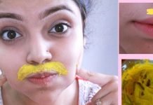 როგორ მოვიშოროთ ტუჩის ზემოთ არსებული თმა? ეს რეცეპტი ნატურალური და უსაფრთხოა…