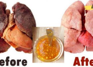 როგორ გავწმინდოთ ფილტვები? ელექსირის რეცეპტი, რომელიც მწეველებს გამოადგებათ