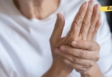 შეზღუდვები ართრიტისთვის: საკვები, რომელიც კლავს თქვენს სახსრებს