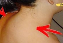 ამ ადამიანს მარილები დაუგროვდა კისერზე… წაიკითხეთ ეს სტატია და მოიშორეთ ტკივილები!