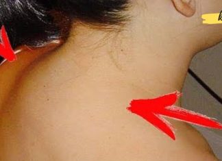 ამ ადამიანს მარილები დაუგროვდა კისერზე… წაიკითხეთ ეს სტატია და მოიშორეთ ტკივილები!