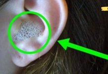 ყურის ცვილის ამოღების 5 გზა: სოდა, მარილი და სხვა საშინაო საშუალებების გამოყენება