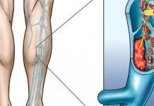 მცენარეული ჩაი ფეხებში სისხლის მიმოქცევის გასაუმჯობესებლად