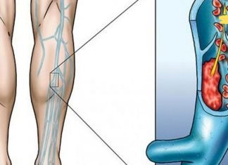 მცენარეული ჩაი ფეხებში სისხლის მიმოქცევის გასაუმჯობესებლად