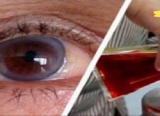 როგორ გავიუმჯობესოთ მხედველობა ოპერაციის გარეშე? ეს სახლის პირობებშიც შეგიძლიათ!