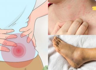 როგორ გავიგოთ გვაქვს თუ არა თირკმლის დაზიანება? ყურადღება მიაქციეთ მაფრთხილებელ ნიშნებს