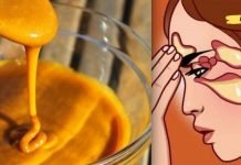 ლორწოს ყველაზე ძლიერი საშუალებები: ჩვენ ვმკურნალობთ ცხვირის გადინებას, სინუსიტს და ხველას 1 დღეში