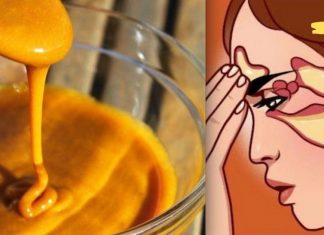 ლორწოს ყველაზე ძლიერი საშუალებები: ჩვენ ვმკურნალობთ ცხვირის გადინებას, სინუსიტს და ხველას 1 დღეში