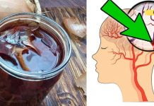 ხალხური მედიცინის რეცეპტი ტვინის სისხლძარღვების გასაწმენდად. ეს ძალიან ეფექტურია