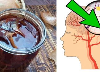 ხალხური მედიცინის რეცეპტი ტვინის სისხლძარღვების გასაწმენდად. ეს ძალიან ეფექტურია