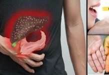 12 ნიშანი იმისა, რომ თქვენი ღვიძლი დაზიანებულია. არ დატოვოთ უყურადღებოდ