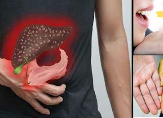 12 ნიშანი იმისა, რომ თქვენი ღვიძლი დაზიანებულია. არ დატოვოთ უყურადღებოდ