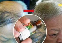 წამალი ჩინეთიდან თმის ცვენის აღმოსაფხვრელად სულ რაღაც 1 თვეში!