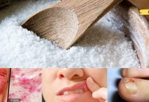 მარილის გამოყენების ჯანსაღი და სასარგებლო გზები. ის უფრო მეტია ვიდრე კერძების დანამატი