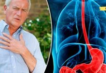 თუ გულძმარვა გაწუხებთ, მაშინ ეს საშუალებები დაგეხმარებათ მის მოხსნაში