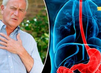 თუ გულძმარვა გაწუხებთ, მაშინ ეს საშუალებები დაგეხმარებათ მის მოხსნაში