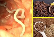 მიხაკი და სელის თესლი დაგეხმარებათ ორგანიზმიდან პარაზიტების მოშორებაში