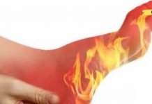 ფეხებში წვის მიზეზები: რატომ “იწვის” ფეხები? ეს უნდა იცოდეთ