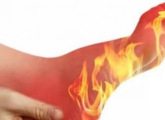 ფეხებში წვის მიზეზები: რატომ “იწვის” ფეხები? ეს უნდა იცოდეთ