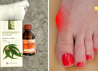 ქლოროფილიპტი არის ხელმისაწვდომი საშუალება 12 დაავადების სამკურნალოდ. აქ არის ყველაზე ეფექტური რეცეპტები
