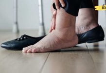 7 მეთოდი, რომელიც დაგეხმარებათ ფეხების შეშუპების დროს! ეს უნდა იცოდეთ