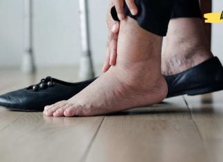 7 მეთოდი, რომელიც დაგეხმარებათ ფეხების შეშუპების დროს! ეს უნდა იცოდეთ