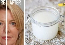 დაბერების საწინააღმდეგო იაპონური პროცედურა: როგორ გამოიყურებოდეთ 10 წლით უფრო ახალგაზრდა