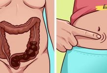 ყაბზობა კლავს თირკმელებს: ბუნებრივი საშუალებები ნაწლავის ფუნქციის გასაუმჯობესებლად