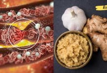 ბუნებრივი სისხლის გამათხელებელი, ამით თავიდან აიცილებთ სისხლის შედედებას!