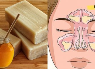 მალამო სინუსიტის სამკურნალოდ. რა საშინაო საშუალებები აღარ ვცადე – მხოლოდ ეს მალამო დამეხმარა!