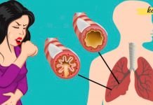 როგორ ამოიღოთ ლორწო და ნახველი ყელიდან და გულმკერდიდან? (მყისიერი შედეგები) გაგიკვირდებათ!