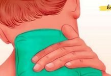 ხშირად გაწუხებთ კისრის ტკივილი? სცადეთ ბებიის მიერ შემოთავაზებული წამალი