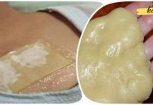 გამოიყენეთ ეს კომპრესი ხველის დროს. ის კურნავს ძლიერ ხველას და შლის ლორწოს ერთ ღამეში