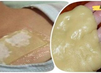 გამოიყენეთ ეს კომპრესი ხველის დროს. ის კურნავს ძლიერ ხველას და შლის ლორწოს ერთ ღამეში