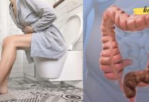 თუ შეკრულობა გაწუხებთ, ამის მოგვარებას სახლის პირობებში საკმაოდ მარტივად შეძლებთ.