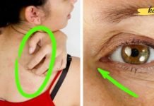 ეს ნიშნები მიუთითებს თქვენს ორგანიზმში შაქრის მაღალ შემცველობაზე.. არ უნდა დააიგნორო!