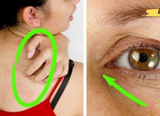 ეს ნიშნები მიუთითებს თქვენს ორგანიზმში შაქრის მაღალ შემცველობაზე.. არ უნდა დააიგნორო!