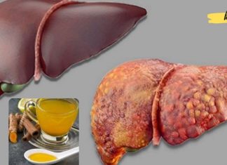 გაიწმინდეთ ღვიძლი ამ 7 ნატურალური პროდუქტით. ამის შემდეგ თქვენი ღვიძლი დაიწყებს იდეალურად მუშაობას..