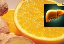 თუ ამ ნიშნებიდან მინიმუმ სამი მაინც გაქვთ, აუცილებლად უნდა გაწმინდოთ ღვიძლი ტოქსინებისგან!